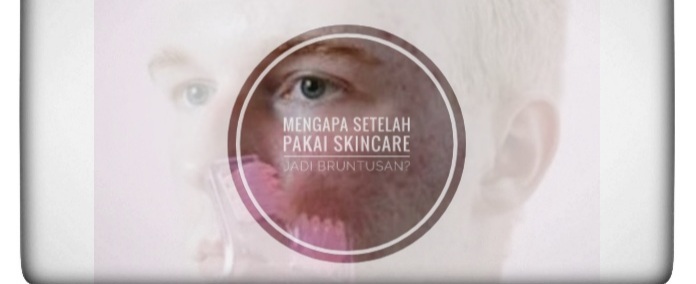 Wajah Bruntusan Setelah Pakai Skincare? Tak Perlu Khawatir, Cukup Lakukan 3 Tips Ini 