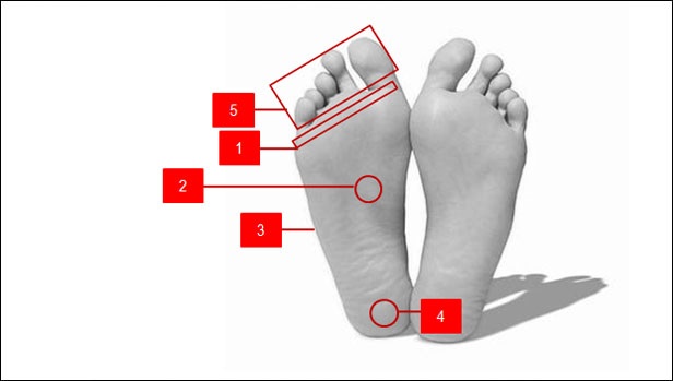 Kedutan Pada Telapak Tangan dan Kaki Merupakan Gejala yang Harus Diperhatikan !