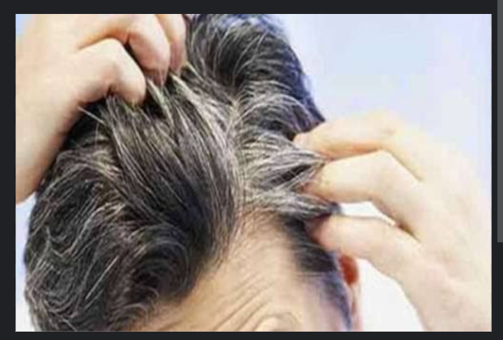 Tips Merawat Rambut Agar Tidak Cepat Beruban, Ini Dia Tips Nya