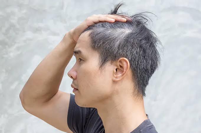 Cara Mudah Menghilangkan Uban Hingga Akar Rambut dengan Bahan Alami