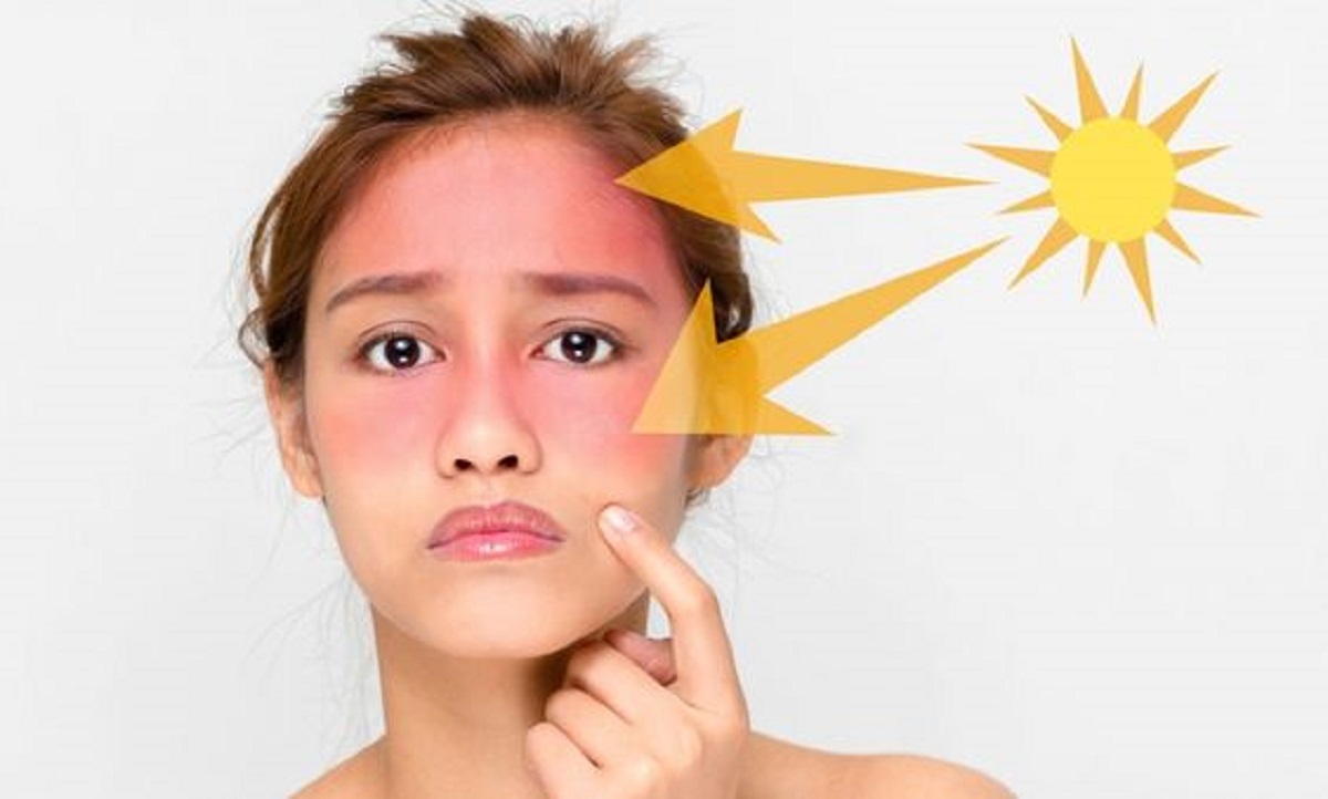 Memilih Sunscreen yang Cocok untuk Muka Kering: Tips dan Rekomendasi Produk