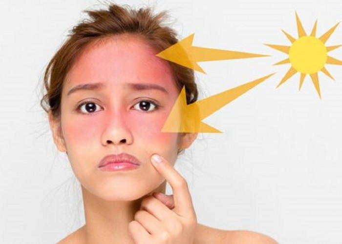 Memilih Sunscreen yang Cocok untuk Muka Kering: Tips dan Rekomendasi Produk